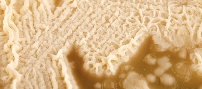 Le Sucre et le Candida Albican (Pr Castronovo)