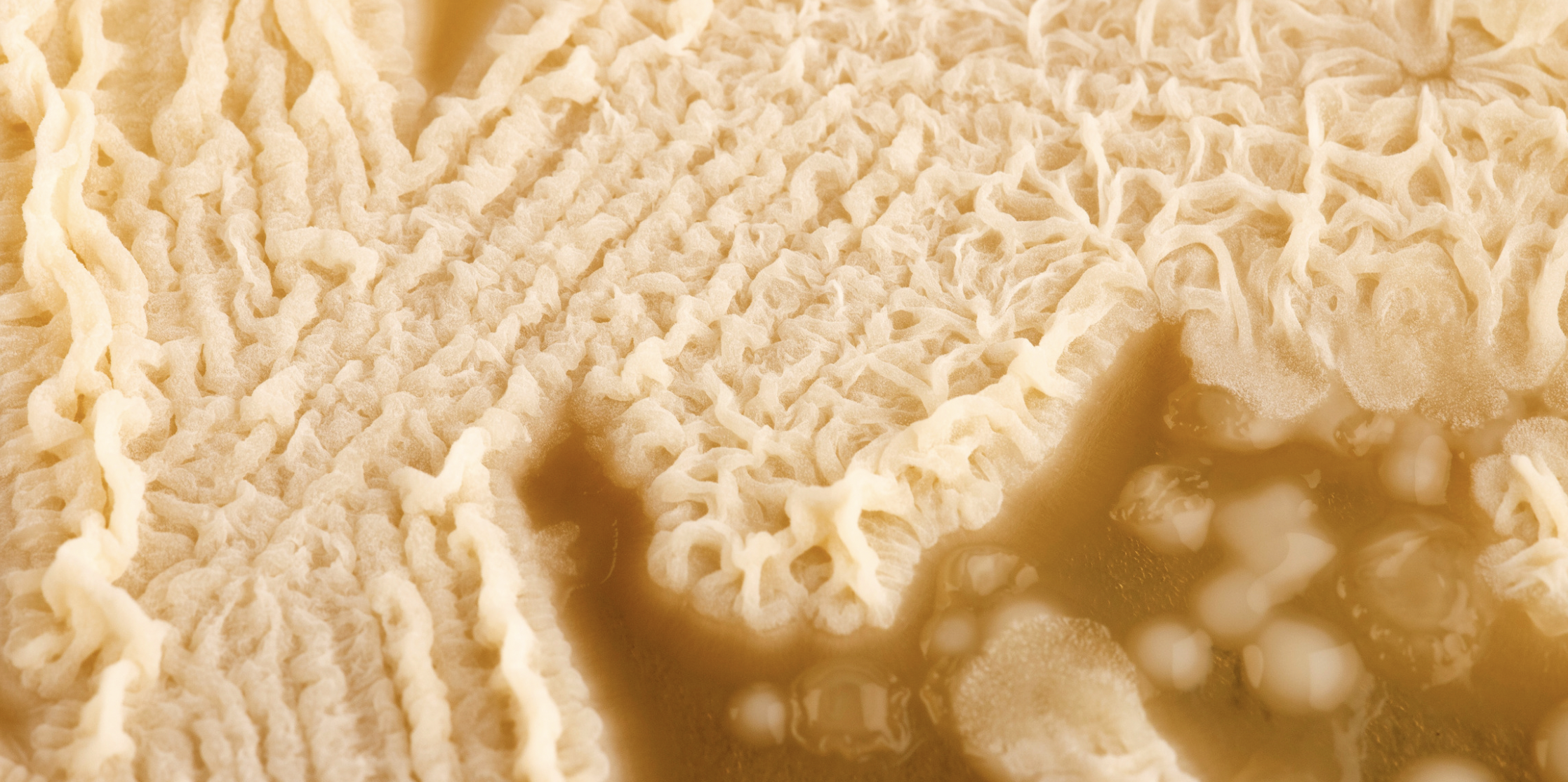 Le Sucre et le Candida Albican (Pr Castronovo)