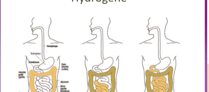 Ballonnements, fatigue, carences ? Et si c’était une malabsorption du grêle ?